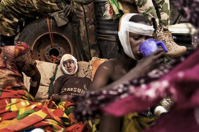 14 enfants blessés après une attaque près de Boali © Camille Lepage