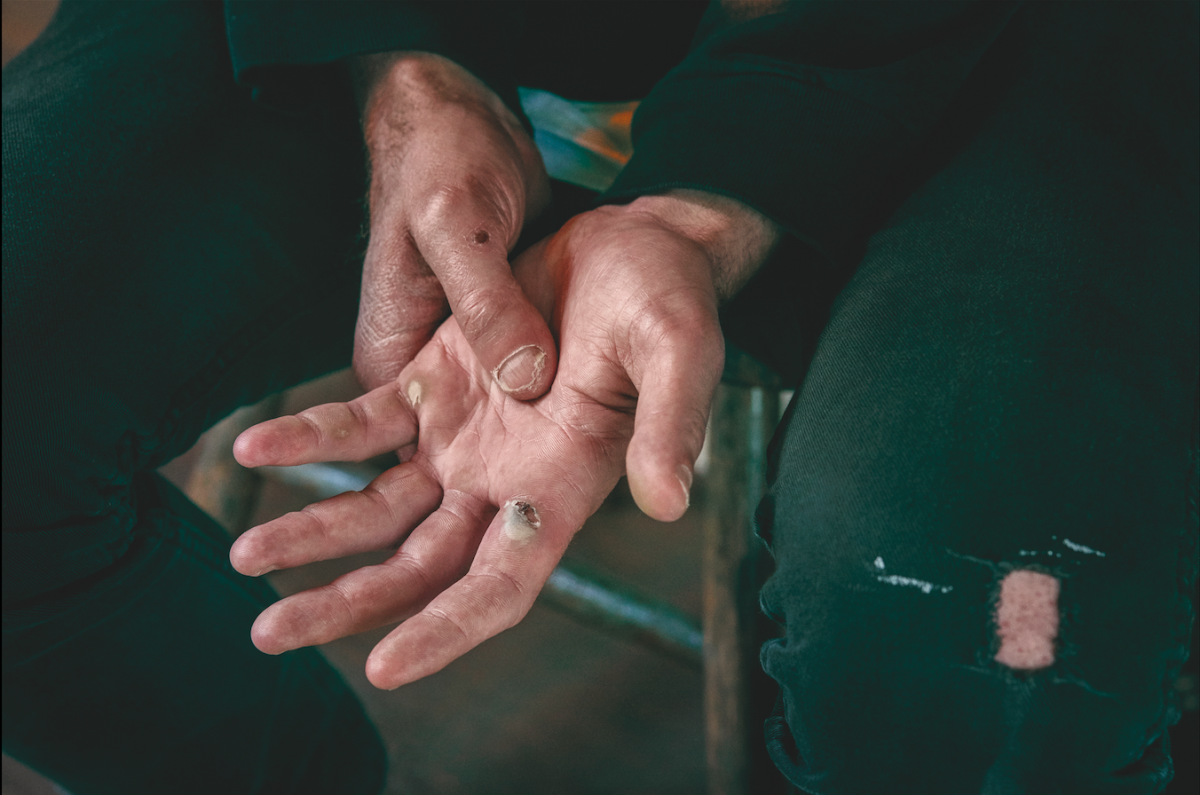 Les mains de Zach Hill, batteur des groupes Death Grips et Hella / © Deirdre O'Callaghan 